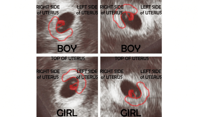 Como descobrir o sexo do bebê usando o Método Ramzi